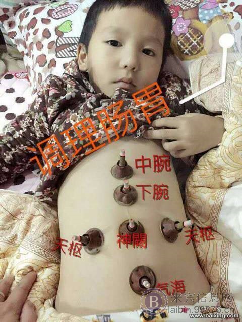 代理艾艾贴,到底有哪些好处?